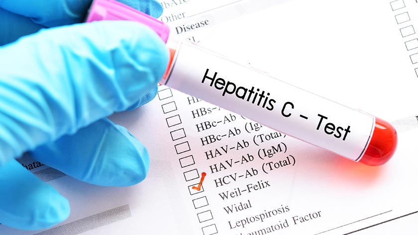 Providing equitable, appropriate care for those with hepatitis C