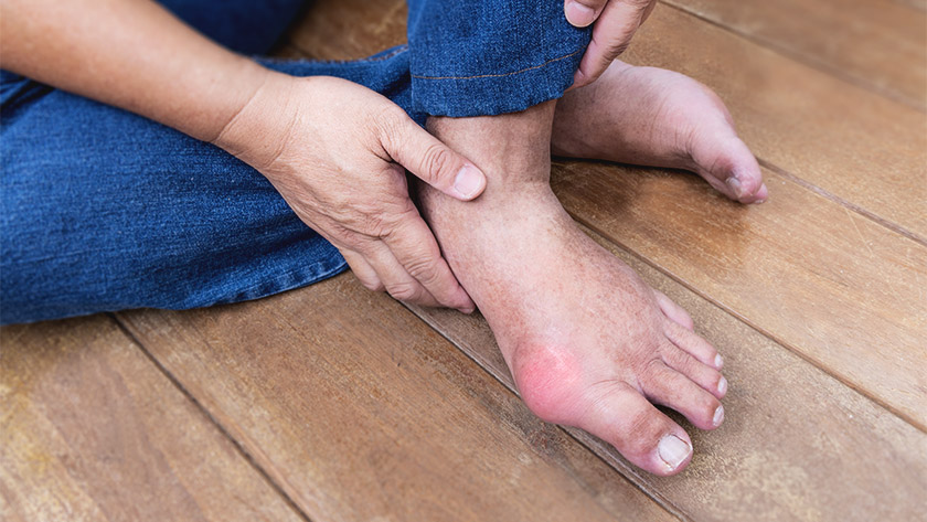 Hand embracing inflammed foot with painful gout on wooden floor