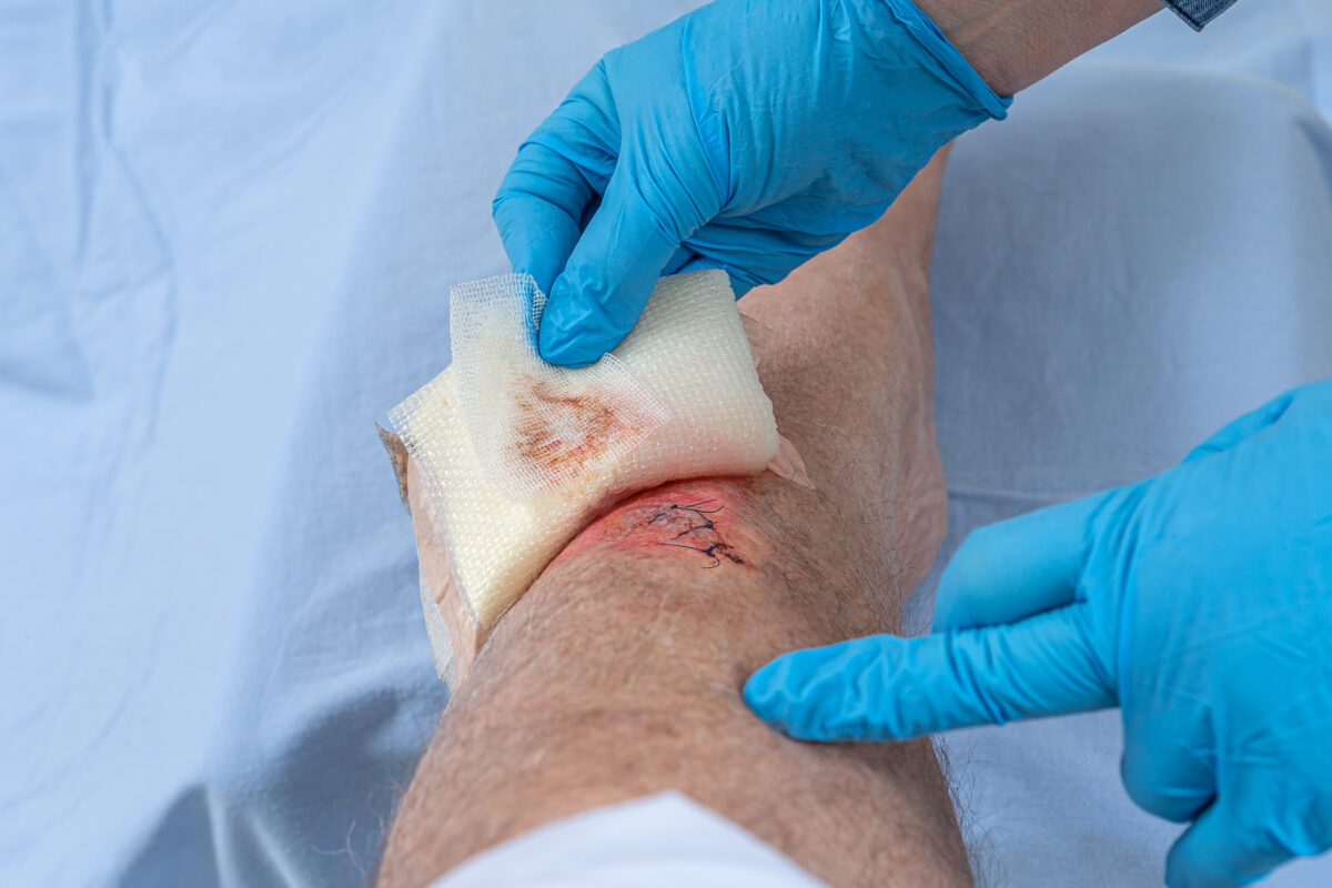Wound care conference important for keeping skills up to date