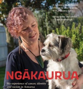 'I've been incredibly lucky these tumours are slow-growing and giving me time.'